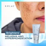 Lilac 3X Spot Lightener- 50gm
