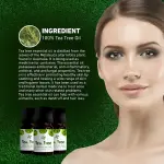 Skin Cafe Tea Tee Essential Oil- 10ml